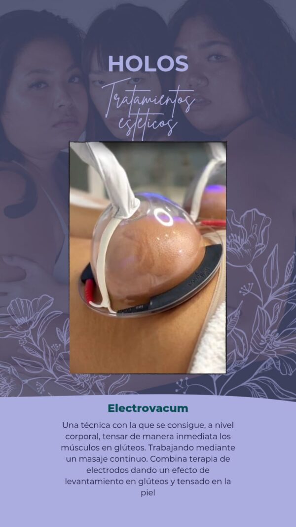 6ff7ad45-bb22-448d-a486-bff93638c1f2 Holos