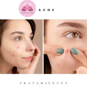 Captura de pantalla 2025-10-15 153425 Flor de Loto